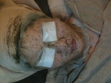 スタッフ藤田　５日間の肌再生プログラムでツルぴか肌への道