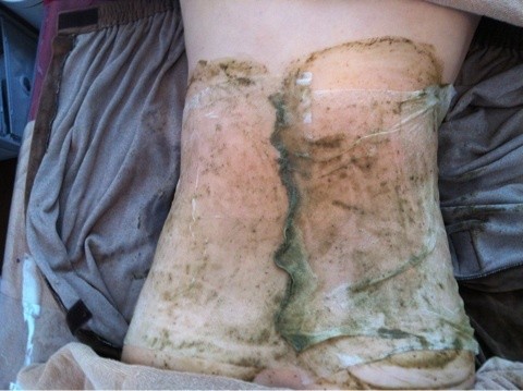 グリーンピールボディー?腰周りのお肉?