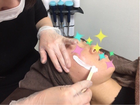 ブライダルエステのシェービングの代わりに美肌スキンケアワックス脱毛